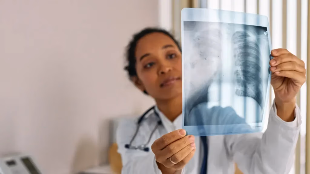 Profissional de saúde a analisar uma radiografia dos pulmões durante a avaliação de uma pessoa com Doença Pulmonar Obstrutiva Crónica (DPOC).