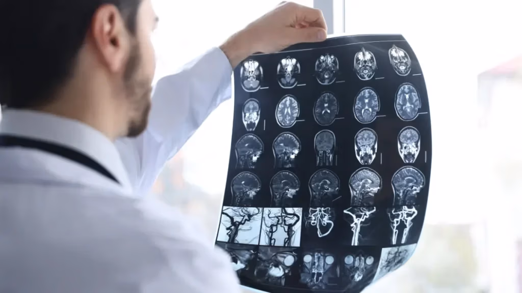Profissional de saúde a analisar exames de imagem cerebral para avaliação de um traumatismo cranioencefálico.